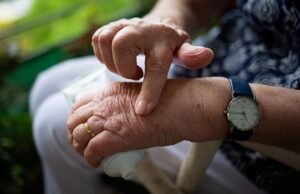 The Harmful Side Effects of Steroid Creams Acne treatment